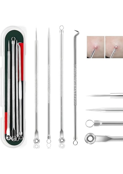 4'lü Kutulu Paslanmaz Çelik Komedon Akne Siyah Nokta Sivilce Siğil Temizleyici Çıkarıcı Seti Gümüş