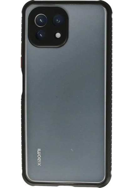 Xiaomi Mi 11 Lite Kılıf Miami Şeffaf Silikon - Siyah