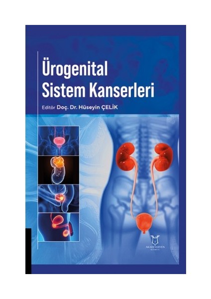 Ürogenital Sistem Kanserleri