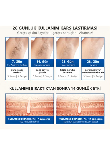 T16 3 Milyon Atım Ev Tipi Ipl Lazer Epilasyon Cihazı - 3 Başlık (Hr+Bk+Fa) indirimleri