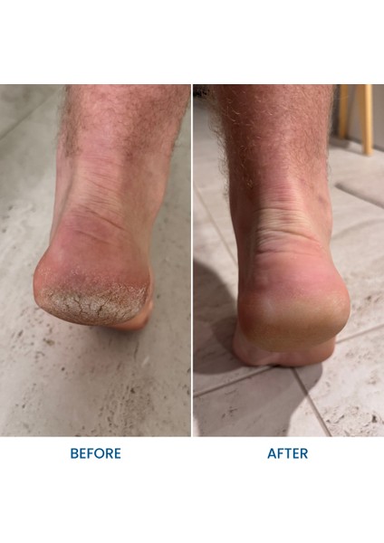 Doğal Ayak ve Topuk Kremi Çatlak Kuru Ayaklar Için Özel Seri 75G modelleri