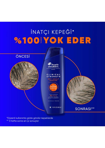 Head & Shoulders Clinical Strength Dry Scalp Rescue Kuru Saç Derisine Özel Şampuan 400 ml