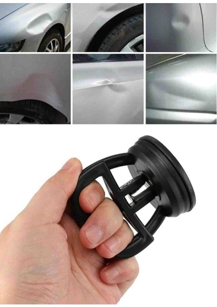 Vakumlu Göçük Düzeltici Aparat