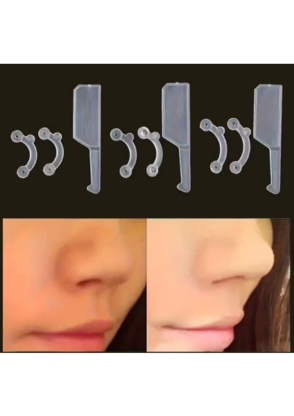 Şeffaf Burun Kaldırma Aparatı, 6 Adet Şefaf Renk Burun Kaldırma, Burun Kaldırma Aparatı fırsatları
