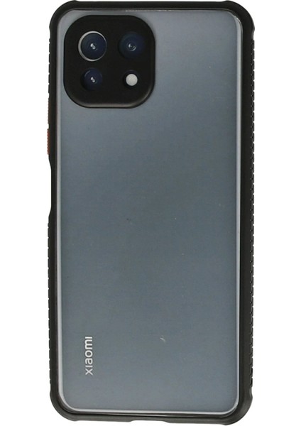 Xiaomi Mi 11 Lite Kılıf Miami Şeffaf Silikon - SIYAH-(5796)