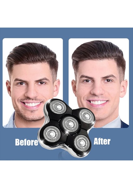 Tıraş Makinesi Yedek Kafa Fit Remington Balder Pro Kafa Tıraş Makinesi XR7000 XR1500 XR1501 Elektrik Tıraş Makinesi Kel Erkekler Için (Yurt Dışından) indirimleri