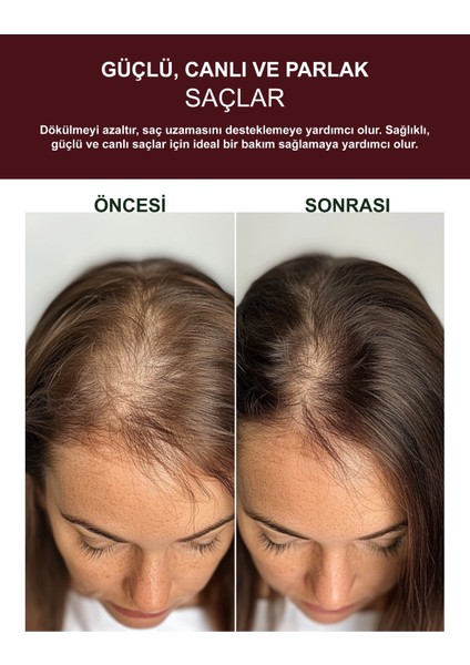 Trichogen Complex Güçlendirici Sarımsak Özlü Tuzsuz Şampuan | Dökülme Karşıtı & Onarıcı (3 Adet x 500 Ml) fırsatları