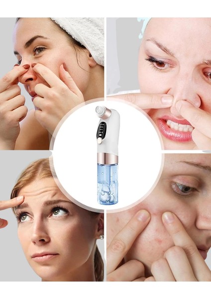 çınar ticaret elektrikli siyah nokta sökücü – derinlemesine gözenek temizleme cihazı modelleri