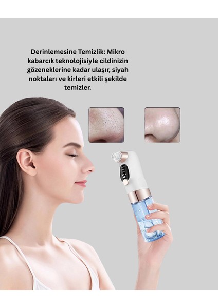 çınar ticaret ayarlanabilir emiş gücü ile profesyonel siyah nokta temizleyici modelleri