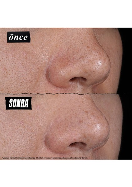 Rare Earth Gözenekleri Derinlemesine Arındıran Kil Maskesi 125 ml modelleri