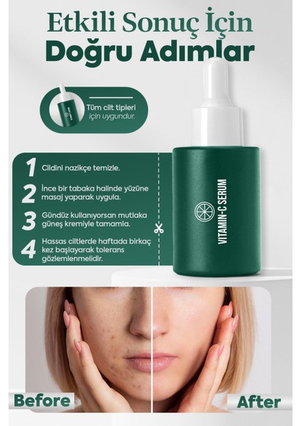 Aydınlatıcı Ton Eşitleyici C Vitamini Serum (NİACİNAMİDE - ARBUTİN-TRANEXAMİC ACİD) indirimleri