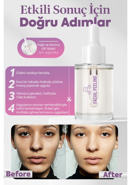 Aha & Bah Ton Eşitleyici,Yenileyici, Aha Peeling Serumu fırsatları