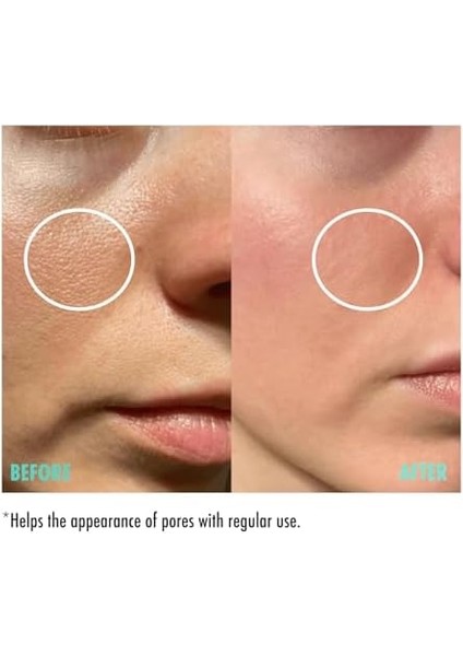 Maru.derm Gözenek Sıkılaştırıcı Cilt Serumu 30 ml