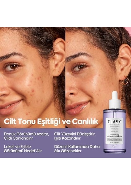 Clasycare Cilt Tonu Eşitleyici Peeling Serum – Aha Bha Eksfoliyan & Gözenek Temizleyici | Salisilik Asit & Glikolik Asit ile Aydınlatıcı, Anti-Aging Cilt Bakımı, 50 ml modelleri