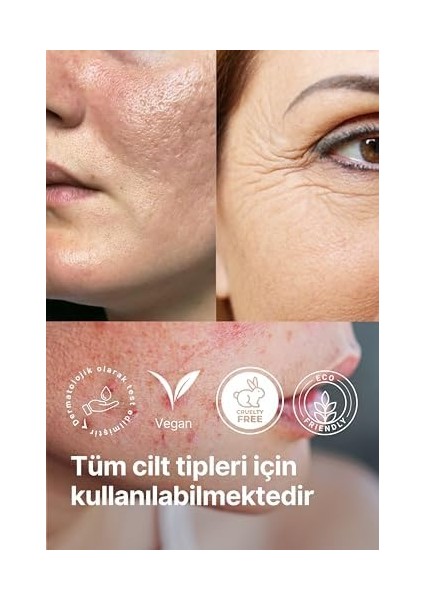 Anocin Aha 20% + Bha 2% Canlandırıcı & Cilt Tonu Eşitleyici Kırmızı Peeling Cilt Serum 5 modelleri