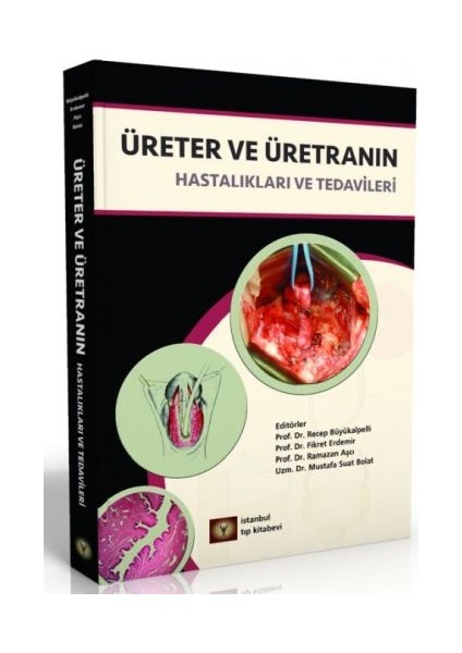 Üreter ve Üretranın Hastalıkları ve Tedavileri