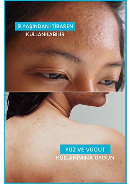 Keracnyl Dengeleyici Temizleme Jeli 100 ml Normal Ciltler İçin Derinlemesine Temizlik