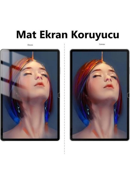 Lenovo Tab TB311FU 10.1 Inç Mat Ekran Koruyucu 9h Nano