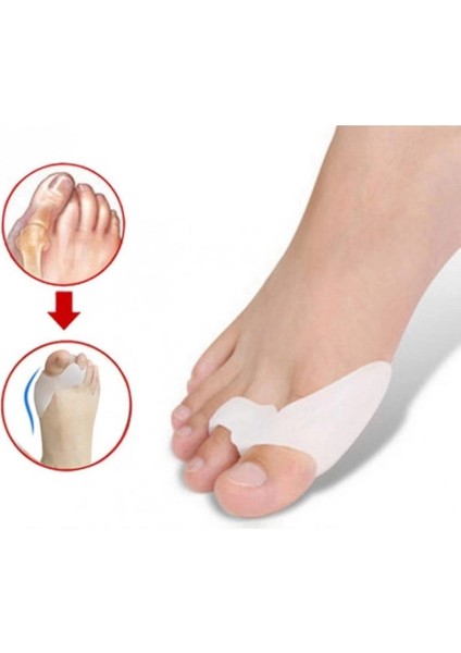 Baş Parmak Bunyon Silikonu Parmak Arası Destek Medikal Silikon Ağrı Azaltmaya Yardımcı fiyatları