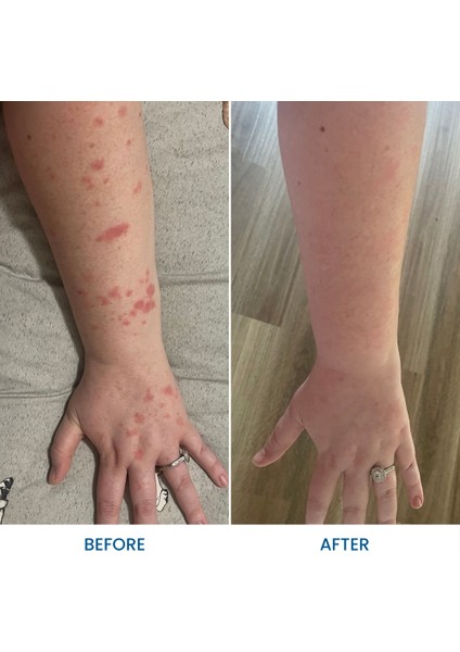 Natural Bakım Kremi 150G Yoğun Nemlendirici fiyatları