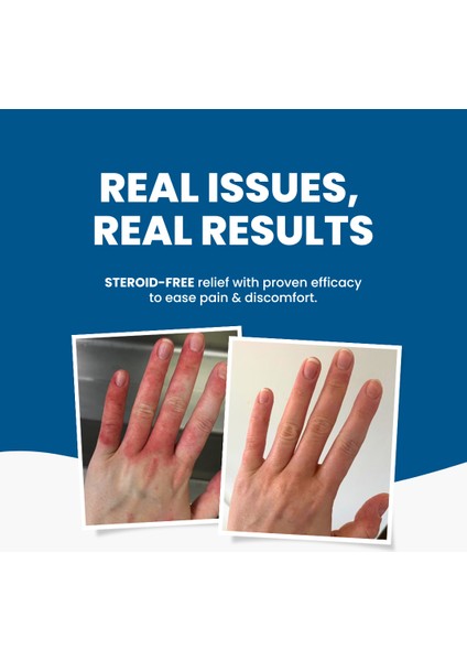 C+ & Egzema Dermatit Rahatlatıcı Krem 120G fiyatları