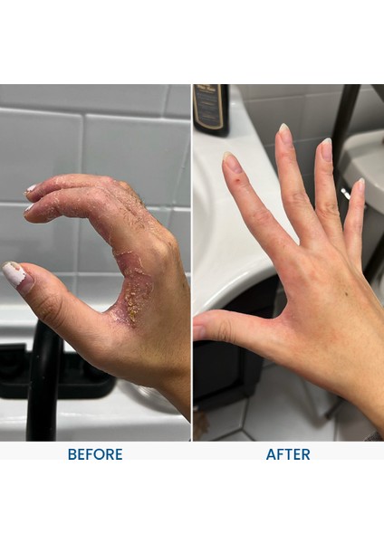 C+ & Egzema Dermatit Rahatlatıcı Krem 120G modelleri