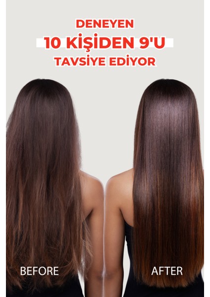 Zigavus Forte Ultra Şampuan Yağlı Saçlar Için 300 ml - 3 Al 2 Öde