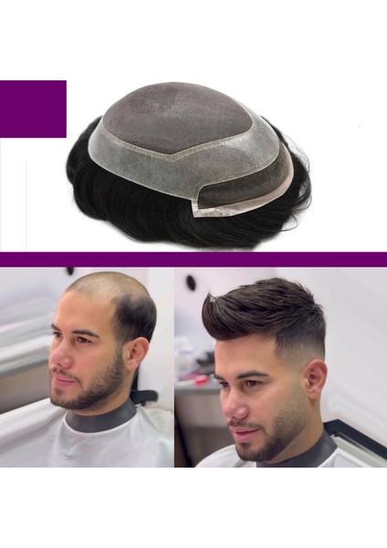 Sacprotezim Yepyeni Bir Sen Sacprotezim Protez Saç Qa8 5x8 Renk 2 Ince Telli Her Yöne Taranabilen Alt Yapı