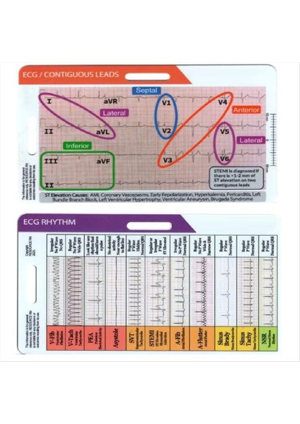 Ekg/ekg Ritim Cep Kartı Akrilik 7 Adım Cetvel Kart Taşınabilir Ekg Ekg Referans Kılavuzu Ritimler Cep Kartı (Yurt Dışından) fiyatları