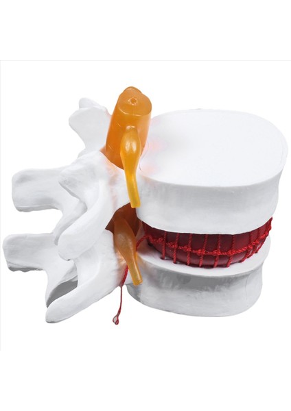 2x Insan Anatomisi Omurga Lomber Disk Herniasyon Öğretim Modeli Beyin Kafatası Travmatik Okul Malzemeleri Enstrümanı (Yurt Dışından) fiyatları