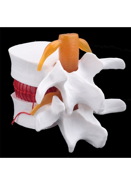 Insan Anatomisi Omurga Lomber Disk Herniasyon Öğretim Modeli Beyin Kafatası Travmatik Okul Malzemeleri Enstrüman (Yurt Dışından)