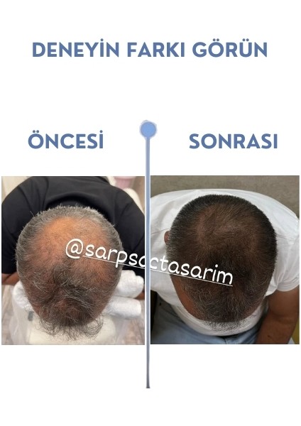 Brown Hair Care Oil fırsatları