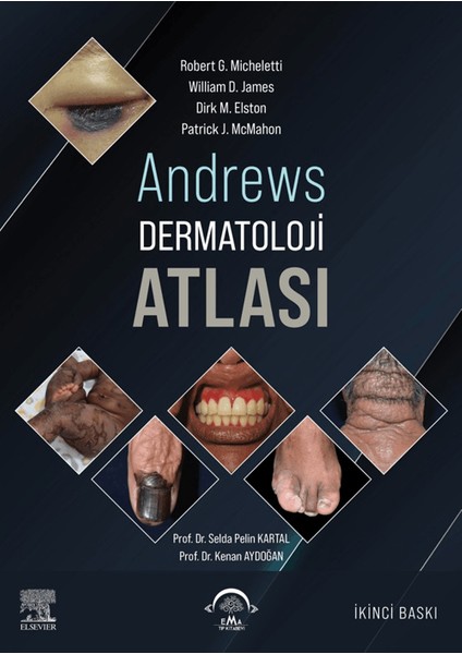 Andrews Dermatoloji Atlası