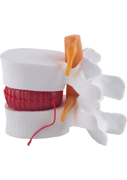 Insan Anatomisi Omurga Lomber Disk Herniasyon Öğretim Modeli Beyin Kafatası Travmatik Okul Malzemeleri Enstrüman (Yurt Dışından) indirimleri