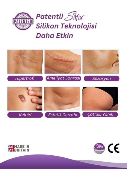 UK Siltape Soft Silikon Bant -dikiş izi-sezaryen-yanık-estetik 2cm x 3mt fırsatları