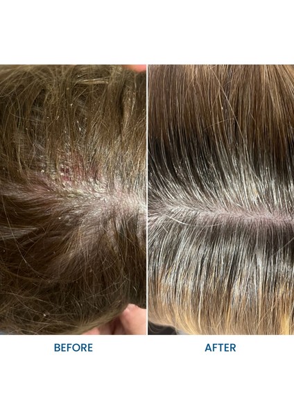 Doğal Saç Derisi Rahatlatıcı Yağ 100ML Hassas Bakım fiyatları