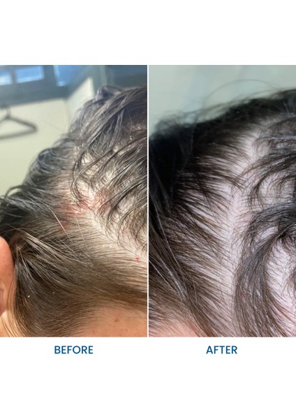 Saç Derisi Rahatlatıcı Şampuan Eğzama , Kepek, Dökülme Karşıtı 250ML fiyatları