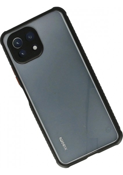 Xiaomi Mi 11 Lite Kılıf Miami Şeffaf Silikon - Siyah fiyatları