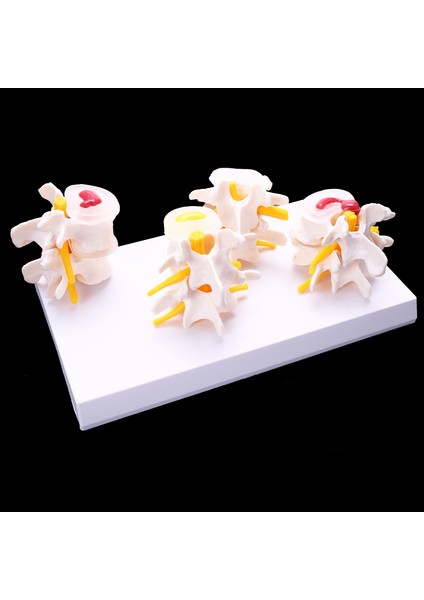 Insan Anatomisi Omurga 4 Aşama Lomber Vertebral Model Beyin Kafatası Travmatik Öğretim Malzemeleri (Yurt Dışından) fiyatları