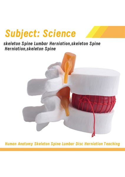 Insan Anatomisi Omurga Lomber Disk Herniasyon Öğretim Modeli Beyin Kafatası Travmatik Okul Malzemeleri Enstrüman (Yurt Dışından) fırsatları
