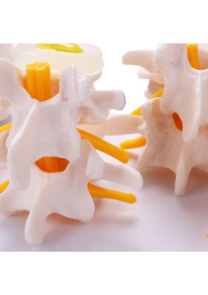 Insan Anatomisi Omurga 4 Aşama Lomber Vertebral Model Beyin Kafatası Travmatik Öğretim Malzemeleri (Yurt Dışından) modelleri