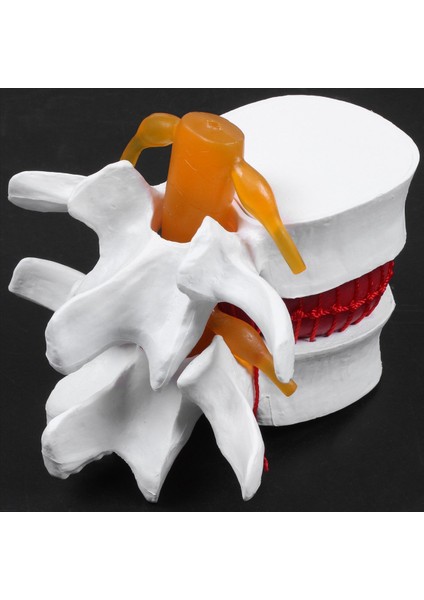 2x Insan Anatomisi Omurga Lomber Disk Herniasyon Öğretim Modeli Beyin Kafatası Travmatik Okul Malzemeleri Enstrümanı (Yurt Dışından) indirimleri