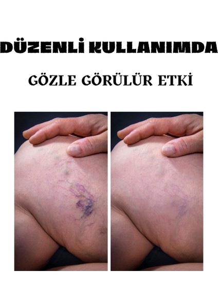 Varicose Veins Var.is Kremi 100 ml modelleri