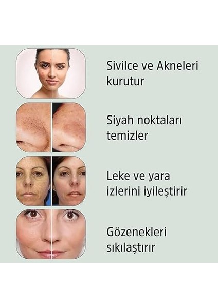 Ölüdeniz Kil Maskesi | Cildinizi Temizler ve Canlandırır | Doğal Yüz Bakımı 50 Ml. fırsatları