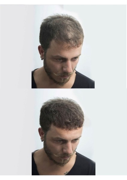 Saç Dolgunlaştırıcı Topik Toz - Dark Brown ve Black 50 gr fiyatları