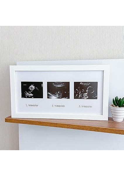 Üçlü Ultrason Anı Çerçevesi - Gebelikte Bebeğin Gelişimini Üç Trimester Anı Olarak Saklayın modelleri