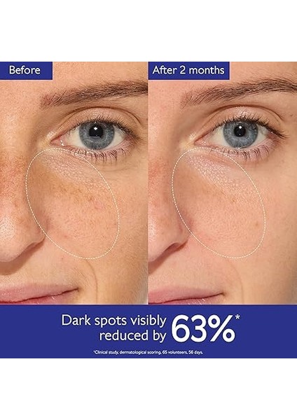 Vinoperfect Leke Karşıtı ve Işıltı Verici Serum 30 ml fırsatları