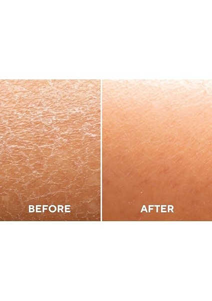 Ceel Yoğun Nemlendirici ve Onarıcı Serum Hyaluronıc Acıd, Sodium Pca, Panthenol B5 Etkili 30 ml fırsatları