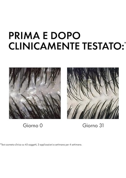 Shampooıng Antı-Pel Gras 390 ml Normal/yağlı Saçlar Için modelleri