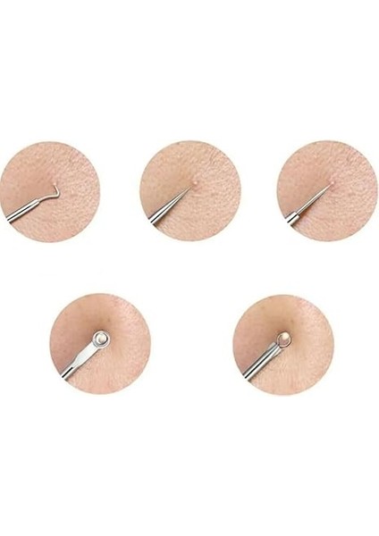 Nokta Akne Temizleyici 4'lü Kutulu Paslanmaz Komedon Gümüş Komedon Seti Sivilce Siyah Nokta Çıkarıcı Kaliteli fırsatları